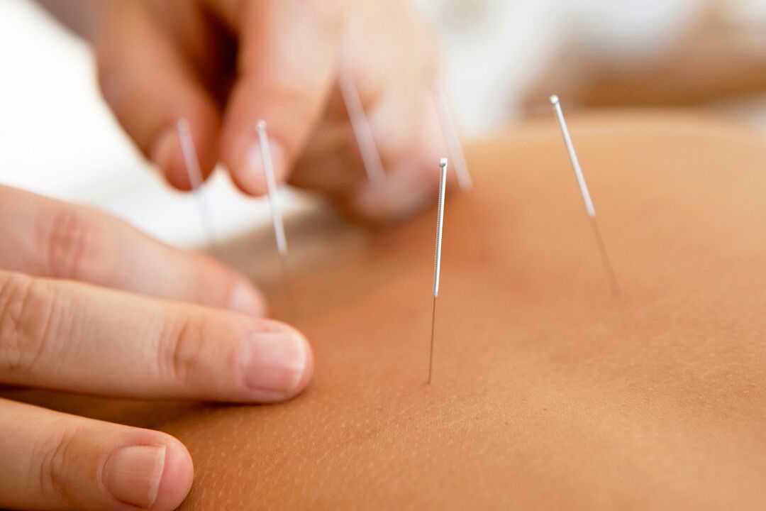 Acupuncture increases effectiveness