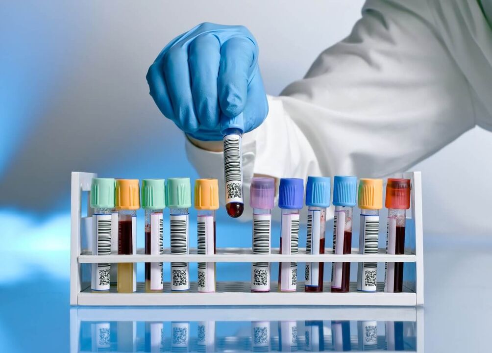 Blood tests for pathological secretions during awakening