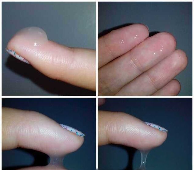 Pre-ejaculate during male sexual arousal