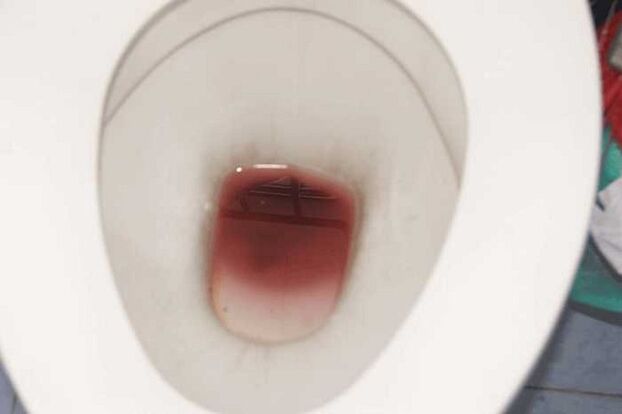 Spots appear when men are excited